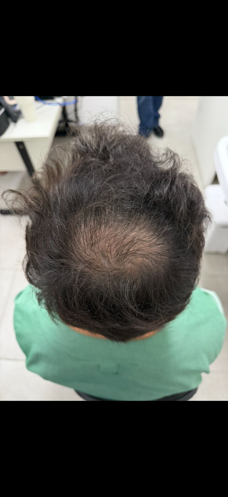 Antes