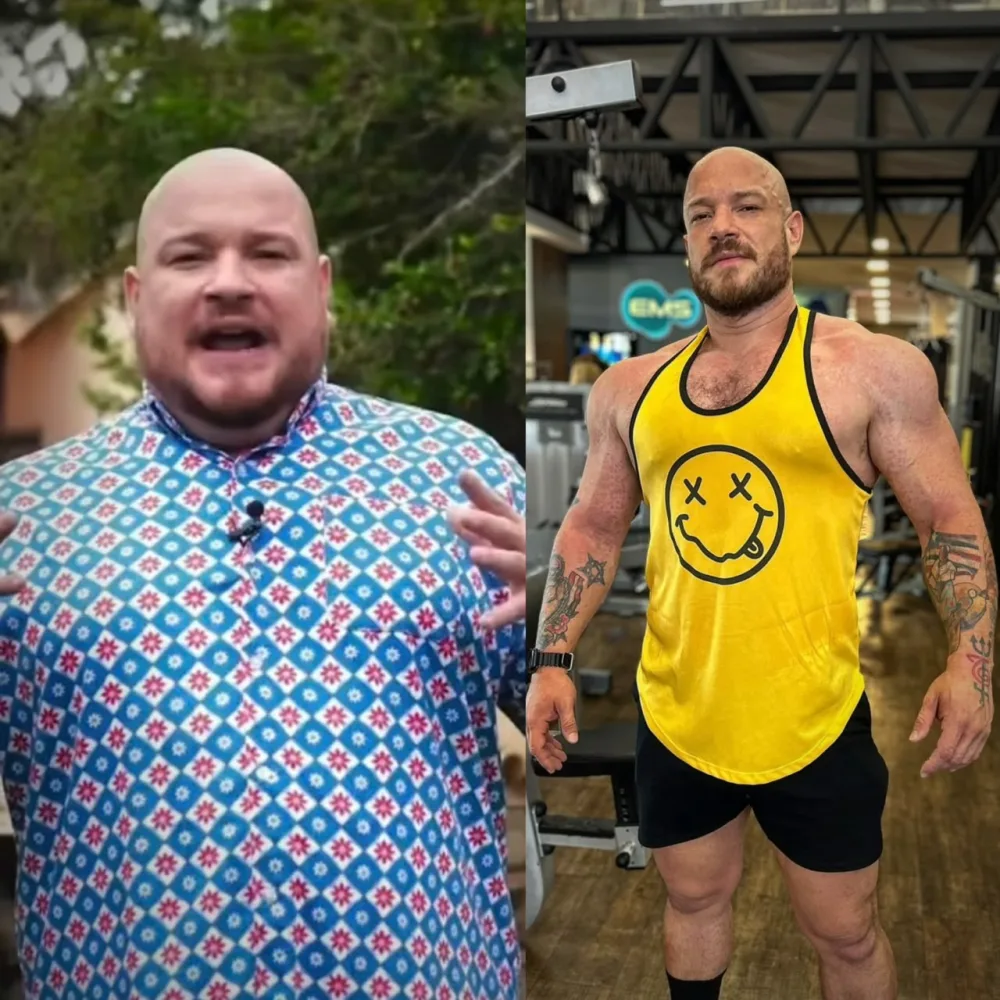 Antes e depois - transformação real de paciente do nutricionista Lucas Peralles em Tatuapé