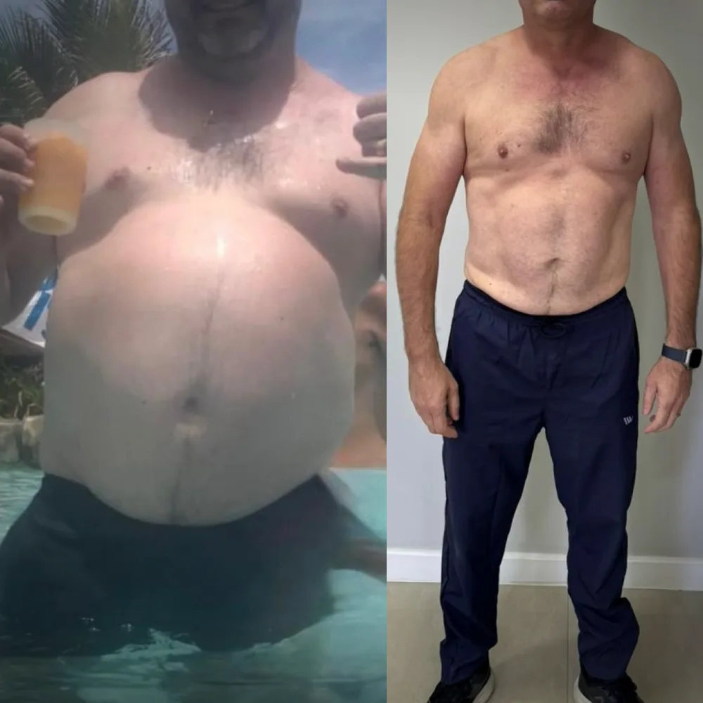 Antes e depois - transformação real de paciente do nutricionista Lucas Peralles em Tatuapé